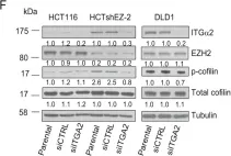 Fig.2.F showing Western Blotting from the publication: EZH2 regulates cofilin activity and colon cancer cell migration by targeting ITGA2 gene.