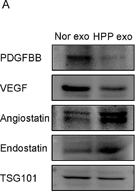 Fig.4.A showing Western Blotting in a Homo sapiens (Human) sample from the publication: ALPL regulates pro-angiogenic capacity of mesenchymal stem cells through ATP-P2X7 axis controlled exosomes secretion.