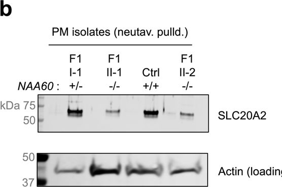 Fig.6.B showing Western Blotting from the publication: Biallelic NAA60 variants with impaired n-terminal acetylation capacity cause autosomal recessive primary familial brain calcifications.