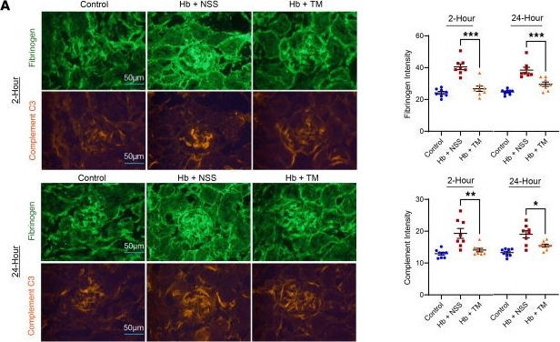 Fig.3.A showing Immunocytochemistry-immunofluorescence from the publication: Thrombomodulin protects against acute vascular and multiorgan injury in sickle cell disease.