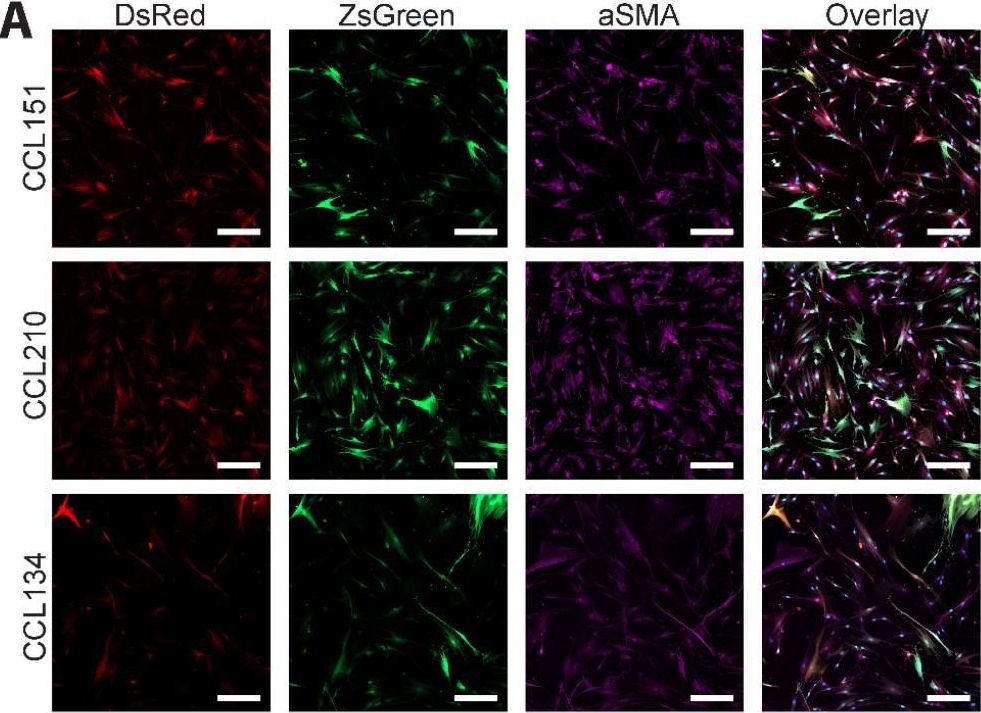Fig.2.A from the publication: Dynamic reporters for probing real-time activation of human fibroblasts from single cells to populations.