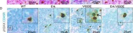 Fig.4.D showing Immunohistochemistry in a Mus musculus (House mouse) sample from the publication: Differential contribution for ERK1 and ERK2 kinases in BRAFV600E-triggered phenotypes in adult mouse models.