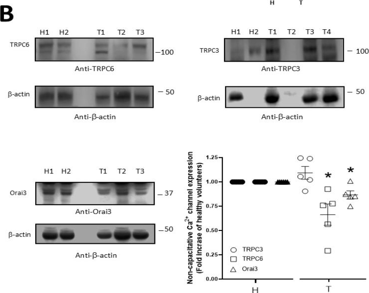 Fig.6.B showing Western Blotting in a Homo sapiens (Human) sample from the publication: Stanniocalcin2, A Promising New Target for Identifying Patients with Stroke/Ictus.