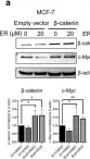 Fig.4.A showing Western Blotting in a Homo sapiens (Human) sample from the publication: Ergosterol inhibits the proliferation of breast cancer cells by suppressing AKT/GSK-3beta/beta-catenin pathway.