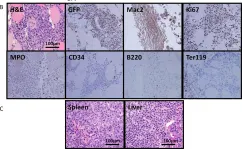 Fig.5.B showing Immunohistochemistry in a Mus musculus (House mouse) sample from the publication: Induction of histiocytic sarcoma in mouse skeletal muscle.