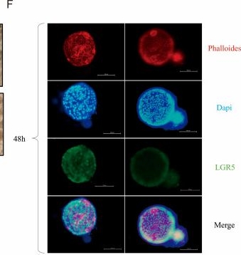 Fig.4.F showing Immunocytochemistry-immunofluorescence in an Anas platyrhynchos (Duck) sample from the publication: Construction of a Duck Intestinal Organoid Culture System: From Crypt Isolation to Medium Optimization.