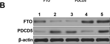 Fig.3.B showing Western Blotting from the publication: Regulation of FTO on PDCD5 mRNA stability to mediate neuron apoptosis in rats with hypoxic-ischemic brain damage.