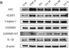 Fig.3.B showing Western Blotting in a Rattus norvegicus (Rat) sample from the publication: The "Tianyu" Formulation Alleviates Rheumatoid Arthritis by Modulating the NLRP3/Caspase-1/GSDMD-Mediated Pyroptosis Pathway.