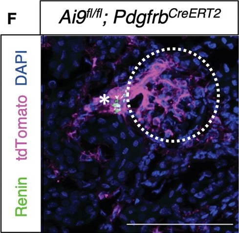 Fig.1.F showing Immunohistochemistry-immunofluorescence from the publication: Renal PIEZO2 is an essential regulator of renin.