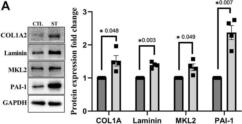 Fig.2.A showing Western Blotting in a Homo sapiens (Human) sample from the publication: Multiomics analysis reveals the mechanical stress-dependent changes in trabecular meshwork cytoskeletal-extracellular matrix interactions.