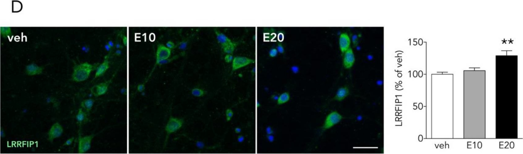 Fig.8.D showing Immunocytochemistry-immunofluorescence in a Rattus norvegicus (Rat) sample from the publication: Comparative Proteomics Unveils LRRFIP1 as a New Player in the DAPK1 Interactome of Neurons Exposed to Oxygen and Glucose Deprivation.