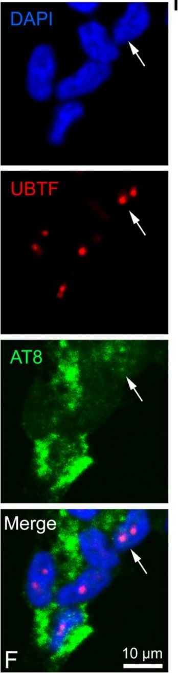 Fig.2.F showing Immunocytochemistry-immunofluorescence in a Homo sapiens (Human) sample from the publication: Cell Cycle Reactivation, at the Start of Neurodegeneration, Induced by Forskolin and Aniline in Differentiated Neuroblastoma Cells.