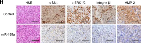Fig.5.H showing Immunohistochemistry in a Homo sapiens (Human) sample from the publication: The hypoxia-related microRNA miR-199a-3p displays tumor suppressor functions in ovarian carcinoma.