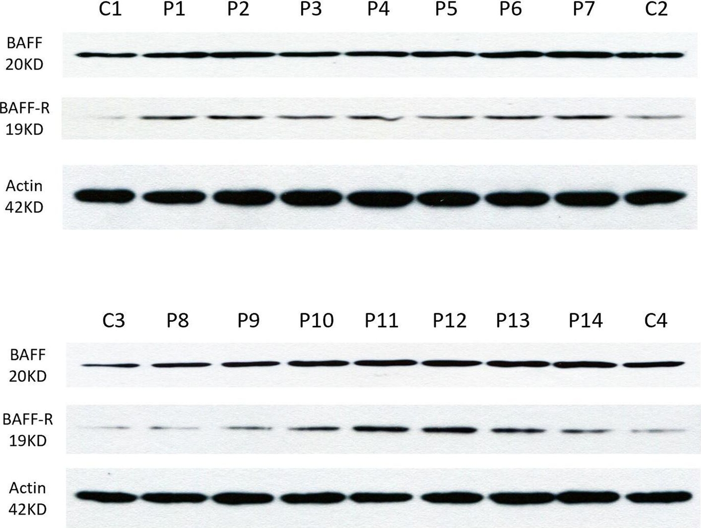 Fig.6.A showing Western Blotting in a Homo sapiens (Human) sample from the publication: Factors associated with refractory autoimmune necrotizing myopathy with anti-signal recognition particle antibodies.
