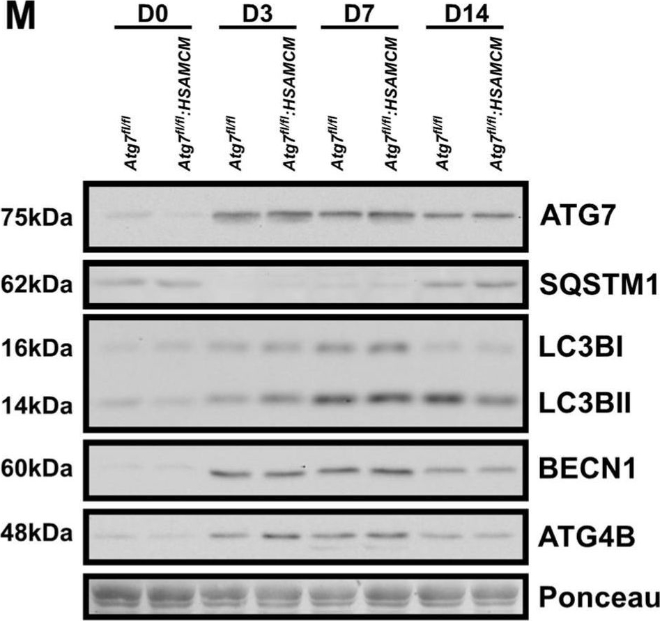 Fig.2.M showing Western Blotting from the publication: Degradative Signaling in ATG7-Deficient Skeletal Muscle Following Cardiotoxin Injury.