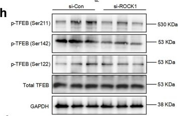 Fig.4.H showing Western Blotting in a Mus musculus (House mouse) sample from the publication: Critical role of ROCK1 in AD pathogenesis via controlling lysosomal biogenesis and acidification.