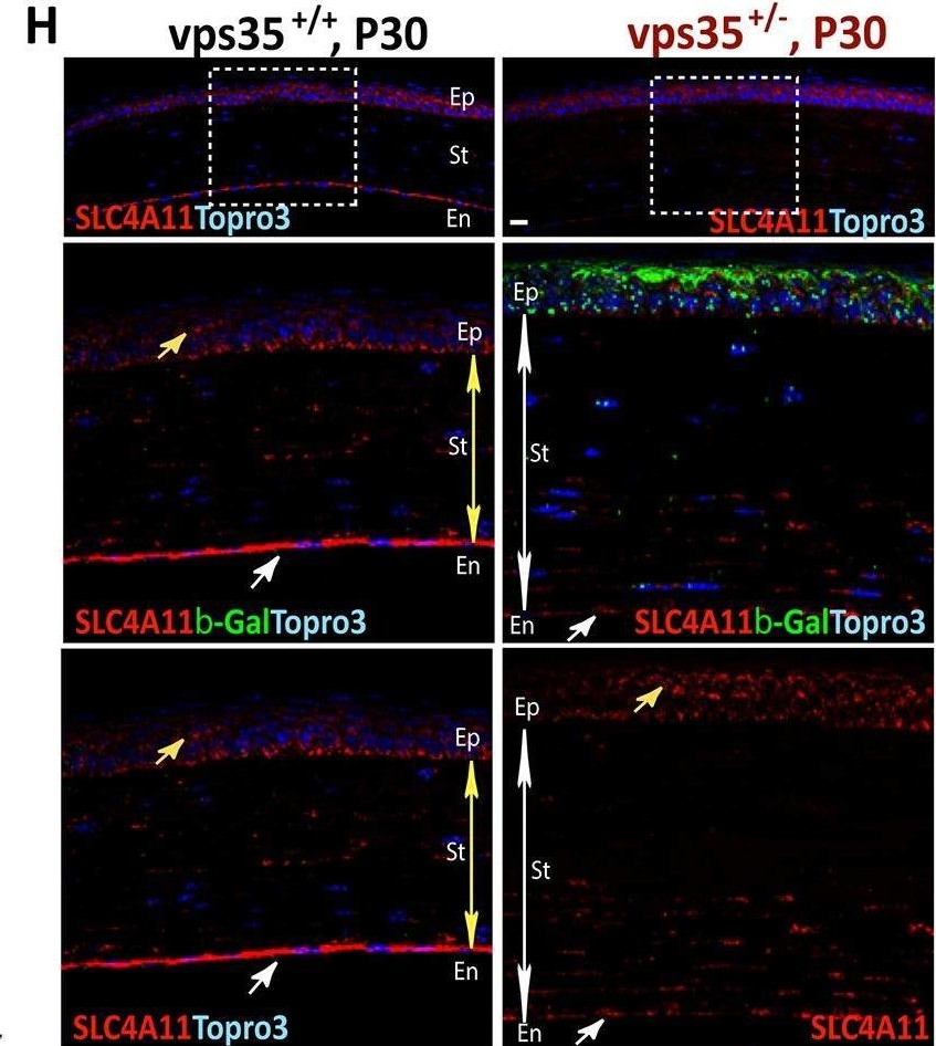Fig.5.H showing Immunohistochemistry-immunofluorescence in a Mus musculus (House mouse) sample from the publication: Vps35-deficiency impairs SLC4A11 trafficking and promotes corneal dystrophy.