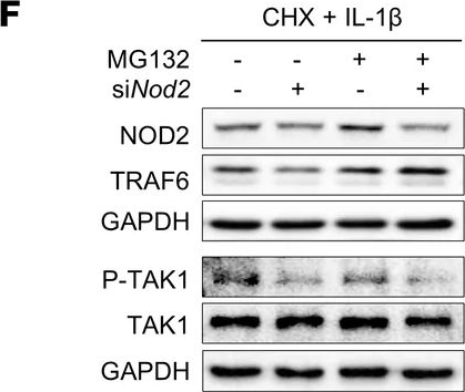 Fig.7.F showing Western Blotting from the publication: Innate immune sensor NOD2 promotes cartilage degradation and osteoarthritis progression by stabilizing TRAF6 in chondrocytes.