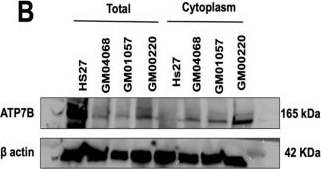 Fig.7.B showing Western Blotting from the publication: Response of Fibroblasts from Menkes' and Wilson's Copper Metabolism-Related Disorders to Ionizing Radiation: Influence of the Nucleo-Shuttling of the ATM Protein Kinase.