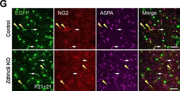 Fig.3.G showing Immunohistochemistry-immunofluorescence in a Mus musculus (House mouse) sample from the publication: Micro-scale control of oligodendrocyte morphology and myelination by the intellectual disability-linked protein acyltransferase ZDHHC9.