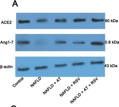Fig.6.A showing Western Blotting in a Mus musculus (House mouse) sample from the publication: Resveratrol Relieves Hepatic Steatosis and Enhances the Effects of Atorvastatin in a Mouse Model of NAFLD by Regulating the Renin-Angiotensin System, Oxidative Stress, and Inflammation.