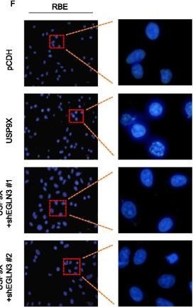 Fig.7.F showing Immunocytochemistry-immunofluorescence in a Homo sapiens (Human) sample from the publication: USP9X promotes apoptosis in cholangiocarcinoma by modulation expression of KIF1Bβ via deubiquitinating EGLN3.