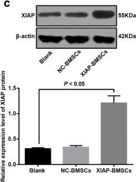 Fig.2.C showing Western Blotting in a Rattus norvegicus (Rat) sample from the publication: Role of XIAP gene overexpressed bone marrow mesenchymal stem cells in the treatment of cerebral injury in rats with cerebral palsy.
