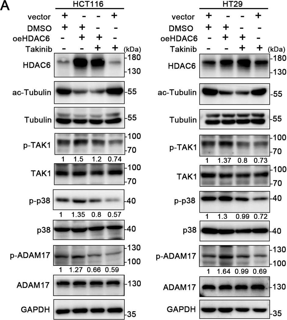 Fig.4.A showing Western Blotting from the publication: HDAC6-dependent deacetylation of TAK1 enhances sIL-6R release to promote macrophage M2 polarization in colon cancer.