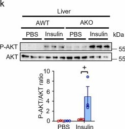 Fig.3.K showing Western Blotting in a Mus musculus (House mouse) sample from the publication: Adipocyte OX40L promotes adipose T cell activation and insulin resistance in obesity.