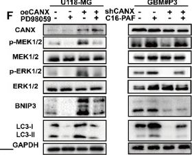 Fig.9.F showing Western Blotting in a Homo sapiens (Human) sample from the publication: Calnexin promotes glioblastoma progression by inducing protective mitophagy through the MEK/ERK/BNIP3 pathway.