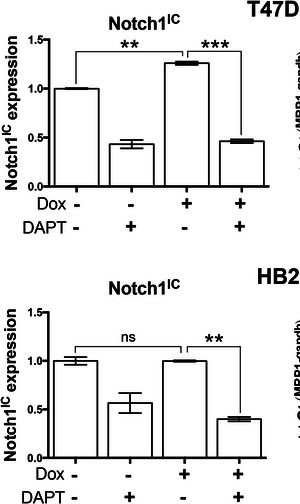 Fig.4.A showing Enzyme-linked immunosorbent assay in a Homo sapiens (Human) sample from the publication: Chemotherapy induces Notch1-dependent MRP1 up-regulation, inhibition of which sensitizes breast cancer cells to chemotherapy.