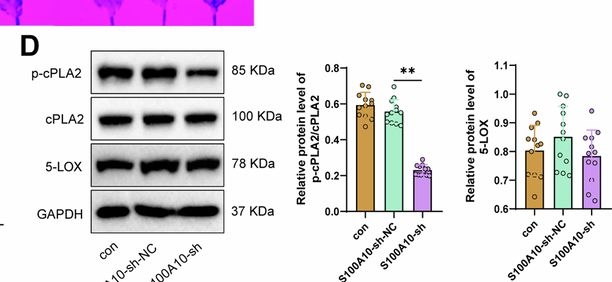Fig.7.D showing Western Blotting in a Mus musculus (House mouse) sample from the publication: Elucidating the role of S100A10 in CD8+ T cell exhaustion and HCC immune escape via the cPLA2 and 5-LOX axis.