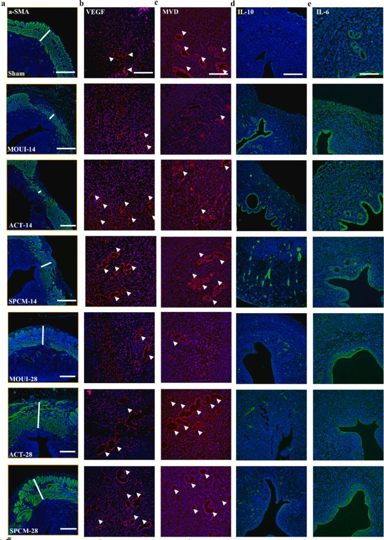 Fig.7.A showing Immunocytochemistry-immunofluorescence from the publication: Spatiotemporal piezoelectric microspheres for wireless endometrial repair with improved pregnancy outcomes.