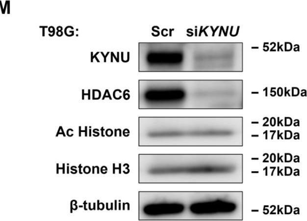 Fig.3.V showing Western Blotting from the publication: Targeting the Kynureninase-HDAC6-Complement Axis as a Novel Therapeutic Strategy in Glioblastoma.