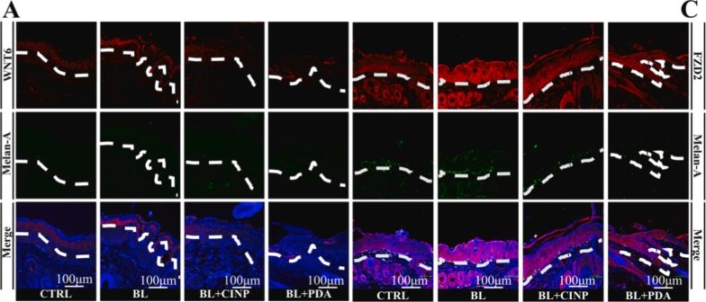 Fig.6.A showing Immunohistochemistry-immunofluorescence from the publication: Bioinspired nanoparticles prevent blue-light-induced skin hyperpigmentation via FZD2-TYR-melanin pathway.