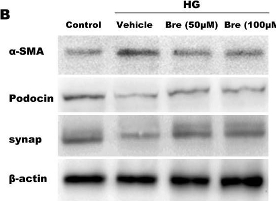Fig.3.B showing Western Blotting in a Mus musculus (House mouse) sample from the publication: Breviscapine alleviates podocyte injury by inhibiting NF-κB/NLRP3-mediated pyroptosis in diabetic nephropathy.