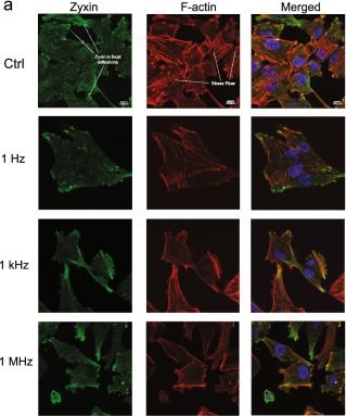 Fig.5.A showing Immunocytochemistry-immunofluorescence in a Homo sapiens (Human) sample from the publication: Effects of high-frequency nanosecond pulses on prostate cancer cells.