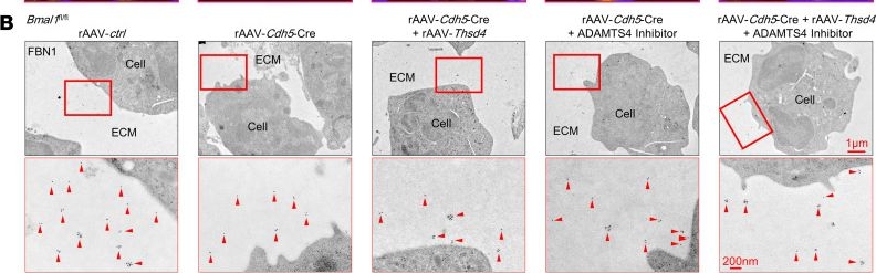 Fig.5.B from the publication: Endothelial BMAL1 decline during aging leads to bone loss by destabilizing extracellular fibrillin-1.