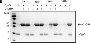 Fig.2.B showing Western Blotting from the publication: Cyclophilin D reduces Ca2+ sequestration by complement 1q binding protein.