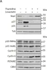 Fig.1.A showing Western Blotting in a Homo sapiens (Human) sample from the publication: Statin-induced depletion of geranylgeranyl pyrophosphate inhibits cell proliferation by a novel pathway of Skp2 degradation.