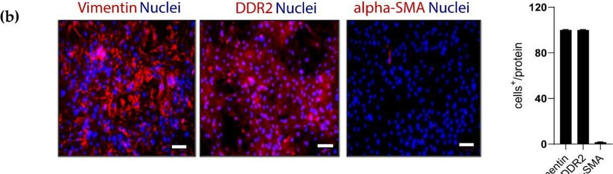 Fig.1.B showing Immunohistochemistry-immunofluorescence in a Homo sapiens (Human) sample from the publication: Cardiac Tissue-like 3D Microenvironment Enhances Route towards Human Fibroblast Direct Reprogramming into Induced Cardiomyocytes by microRNAs.