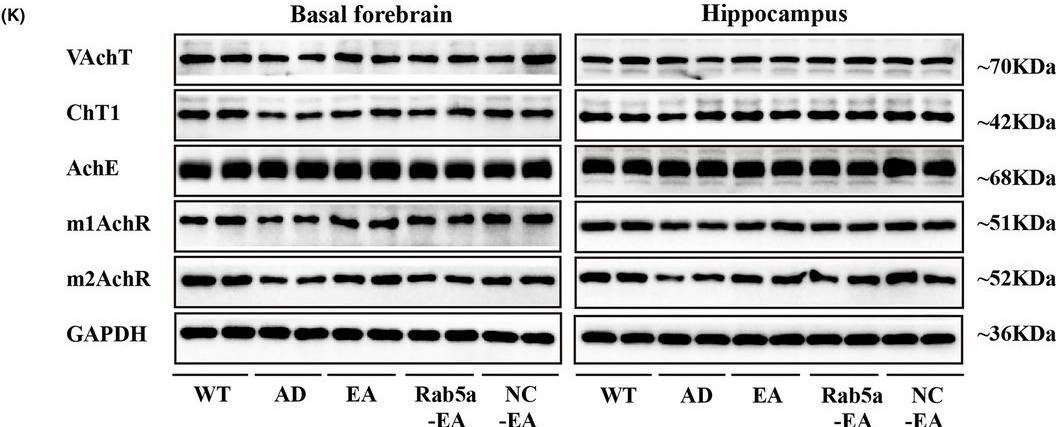 Fig.7.K showing Western Blotting in a Mus musculus (House mouse) sample from the publication: Electroacupuncture regulates Rab5a-mediating NGF transduction to improve learning and memory ability in the early stage of AD mice.
