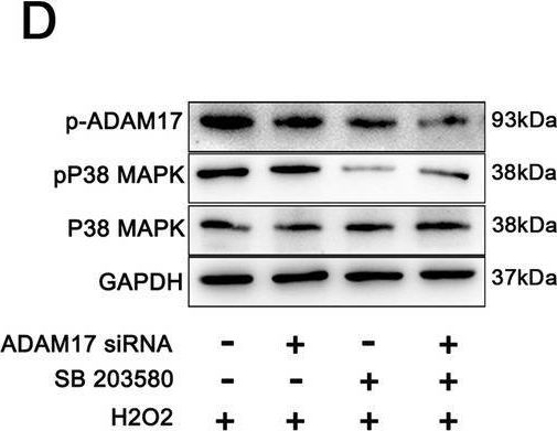 Fig.7.D showing Western Blotting from the publication: P38 MAPK activated ADAM17 mediates ACE2 shedding and promotes cardiac remodeling and heart failure after myocardial infarction.