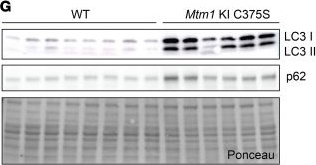 Fig.7.G showing Western Blotting from the publication: Lack of myotubularin phosphatase activity is the main cause of X-linked myotubular myopathy.