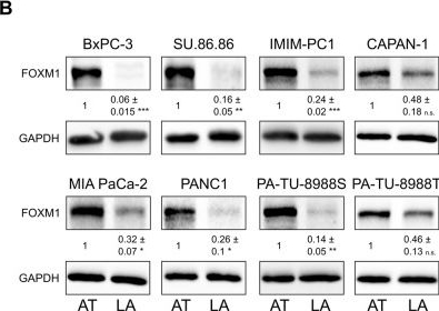 Fig.3.B showing Western Blotting from the publication: FOXM1 regulates platelet-induced anoikis resistance in pancreatic cancer cells.