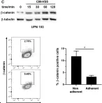 Fig.2.C showing Flow cytometry/Cell sorting in a Homo sapiens (Human) sample from the publication: Identification of the Axis β-Catenin-BTK in the Dynamic Adhesion of Chronic Lymphocytic Leukemia Cells to Their Microenvironment.