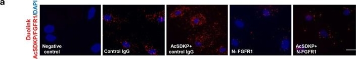 Fig.1.A showing Immunocytochemistry-immunofluorescence in a Homo sapiens (Human) sample from the publication: FGFR1 is critical for the anti-endothelial mesenchymal transition effect of N-acetyl-seryl-aspartyl-lysyl-proline via induction of the MAP4K4 pathway.