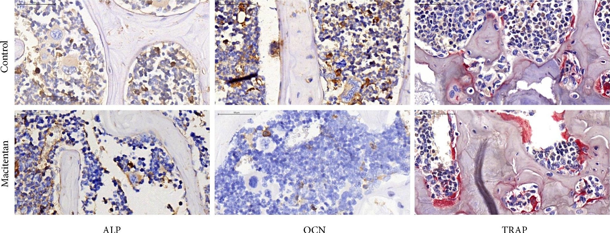 Fig.3.A showing Immunohistochemistry in a Mus musculus (House mouse) sample from the publication: Less Vertebral Bone Mass after Treatment with Macitentan in Mice: A Pilot Study.