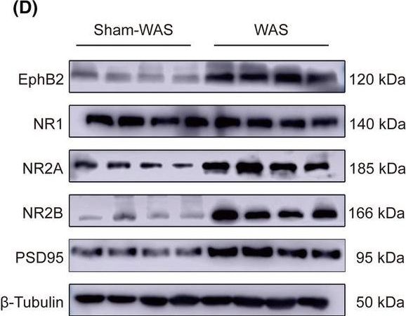 Fig.4.D showing Western Blotting in a Rattus norvegicus (Rat) sample from the publication: Overexpression of EphB2 in the basolateral amygdala is crucial for inducing visceral pain sensitization in rats subjected to water avoidance stress.