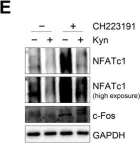 Fig.6.E showing Western Blotting from the publication: Inhibition of Human Osteoclast Differentiation by Kynurenine through the Aryl-Hydrocarbon Receptor Pathway.